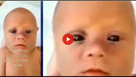 Doctor discusses the black eyed babies. They are mutants and it gets worse from there
