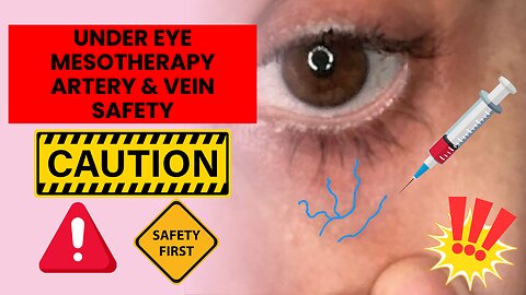 Under Eye Mesotherapy Artery & Vein Safety