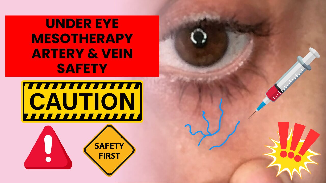 Under Eye Mesotherapy Artery & Vein Safety