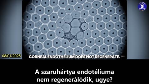 【HU】A Pfizer COVID-19 mRNS vakcinája a nem megújuló szemsejtek 8,4%-át pusztítja el