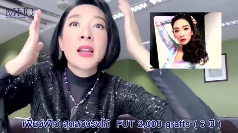 ปลูกผม ด้วยขั้นตอน FUE / FUT และการดูแล ปฏิบัติหลังศัลยกรรมปลูกผม