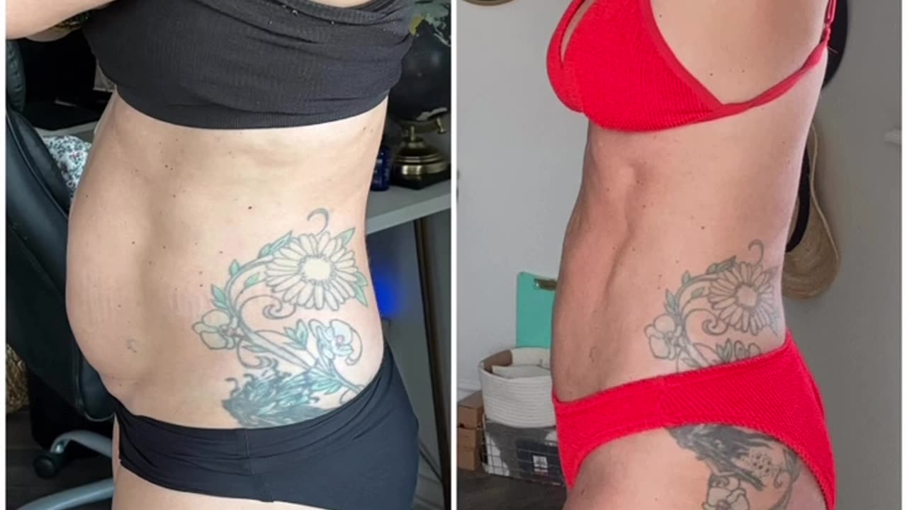 Is Airsculpt Worth It?