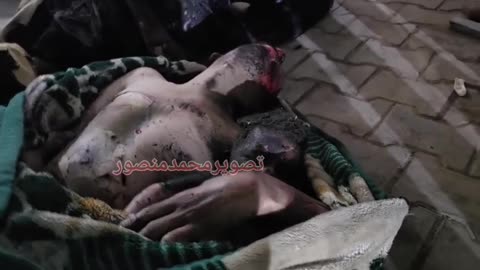 BREAKING | In a new massacre for the displaced (Graphic warning)