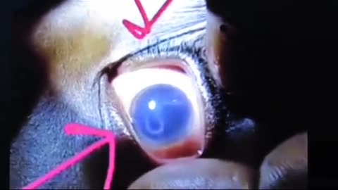 😱👻 Weird Worm-Like Creature Found in Deceased Boy's Eye! Ghostly Toksa | TheHauntingHour