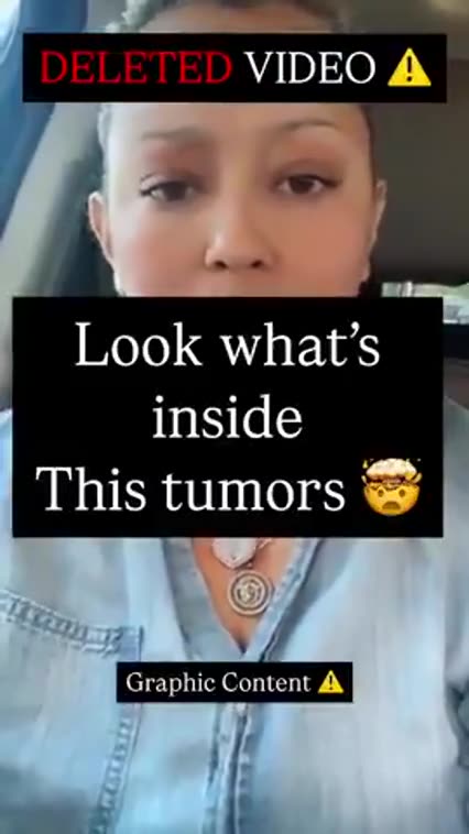 IT TURNS OUT TUMORS CAN HOLD PARASITES