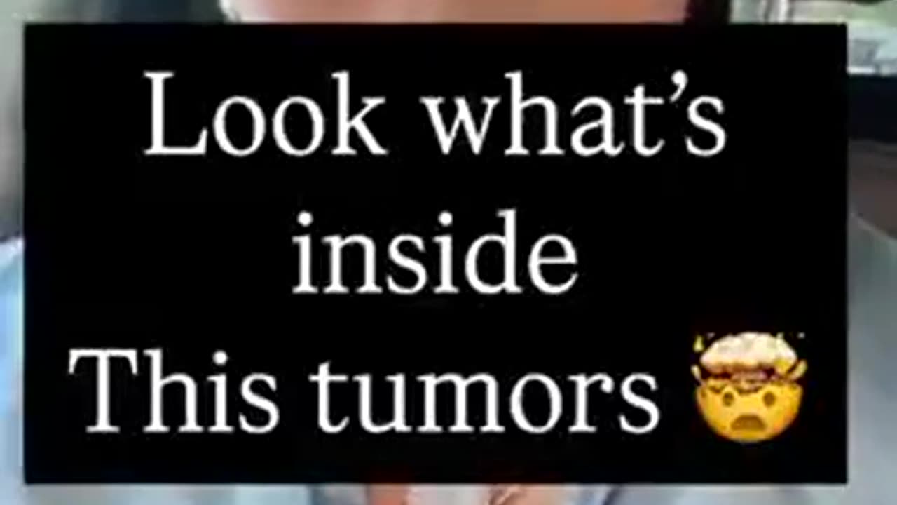 IT TURNS OUT TUMORS CAN HOLD PARASITES