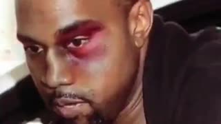 Are you familiar with what the Black Eye Club is?