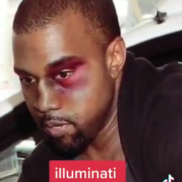 Are you familiar with what the Black Eye Club is?