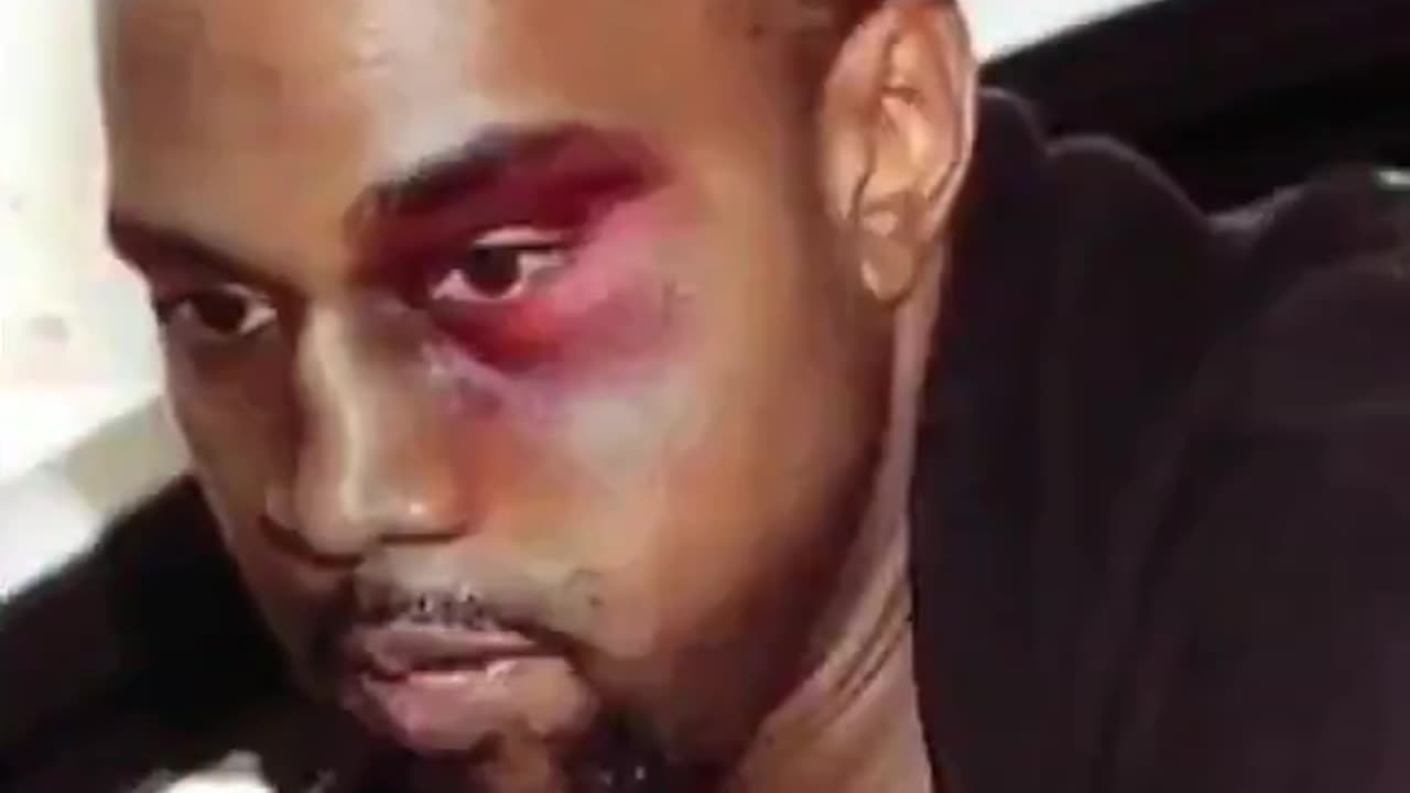 Are you familiar with what the Black Eye Club is?