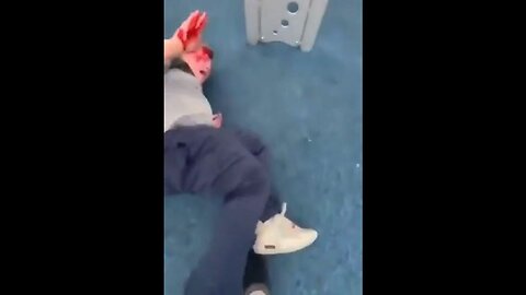 Young White Boy Is Beaten Bloody By Two Black Youths At An Indiana Park