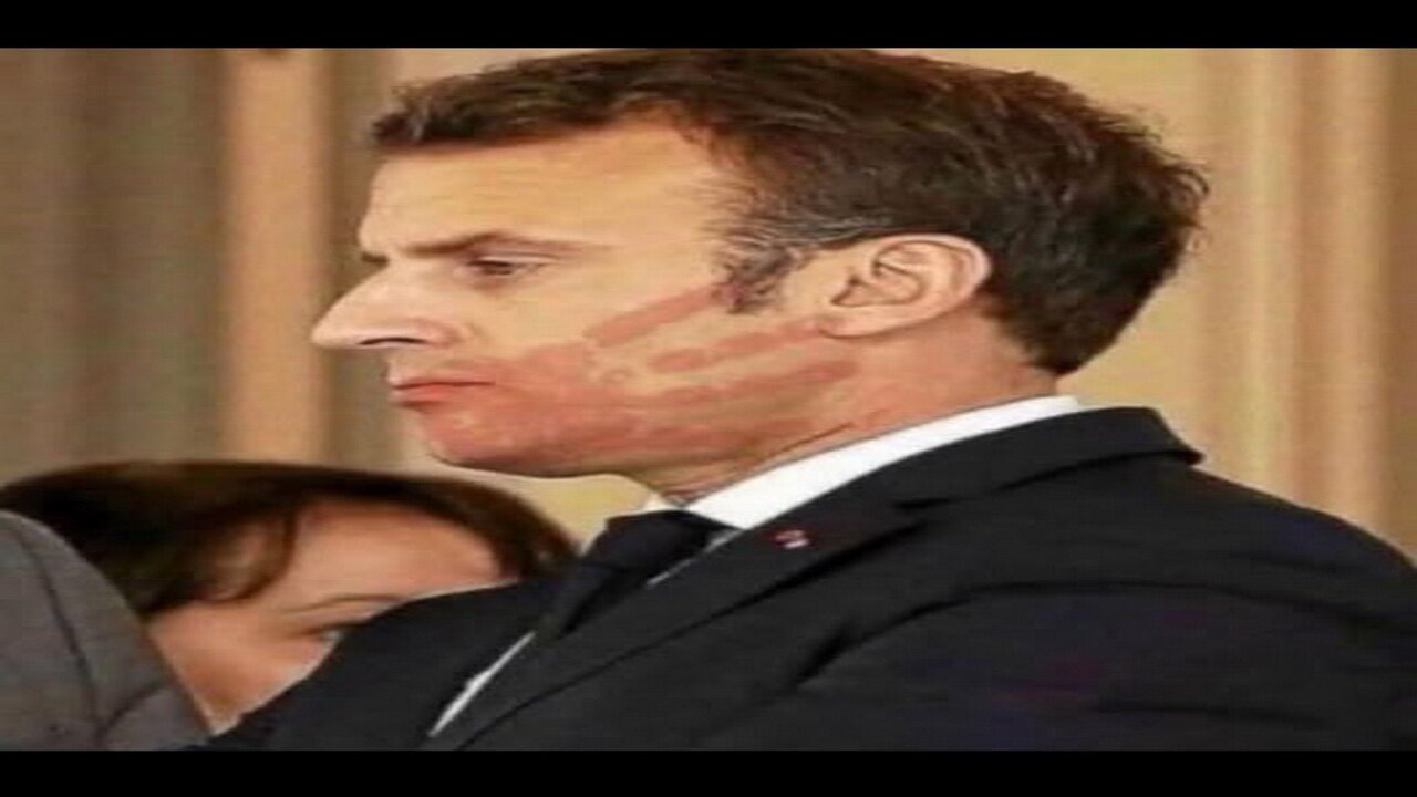 fren news17 Slap Heard Around the World