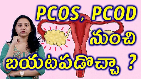 PCOS PCOD నుంచి బయటపడొచ్చా? How to Get Out From PCOS PCOD Homeopathy Treatment Solution Cure Medcine
