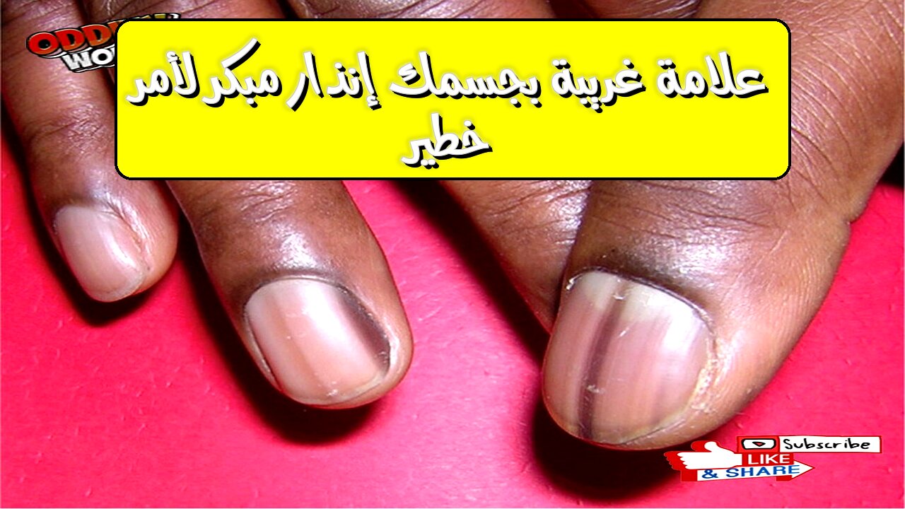 علامة غريبة بجسمك؟ إنذار مبكر لأمر خطير! #صحة #طب #وقاية