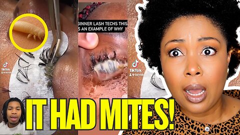EYE INFECTION NIGHTMARE FROM FALSE LASHES