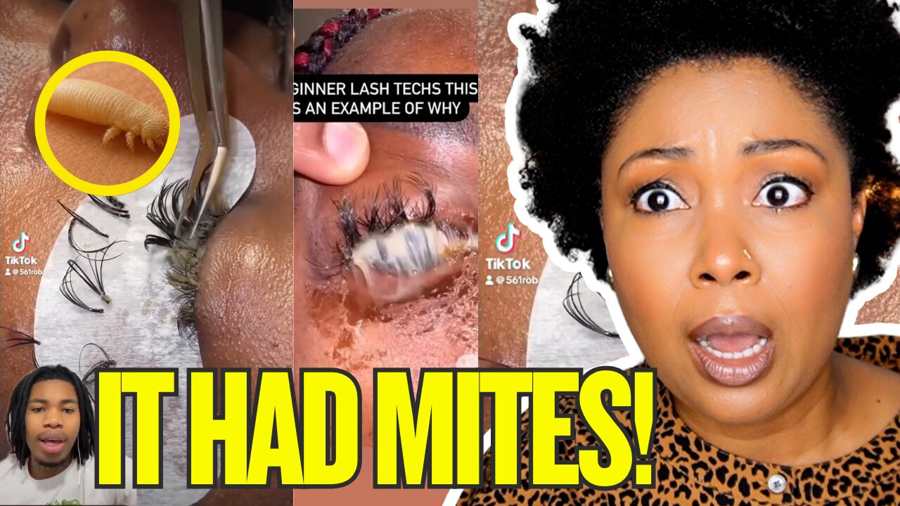 EYE INFECTION NIGHTMARE FROM FALSE LASHES