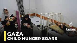Visible signs of malnutrition appear among people in Gaza: AJE correspondent
