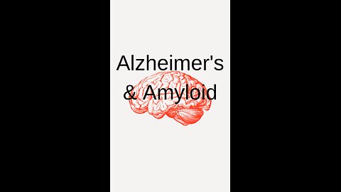 Drug that doesn't work on Alzheimer's
