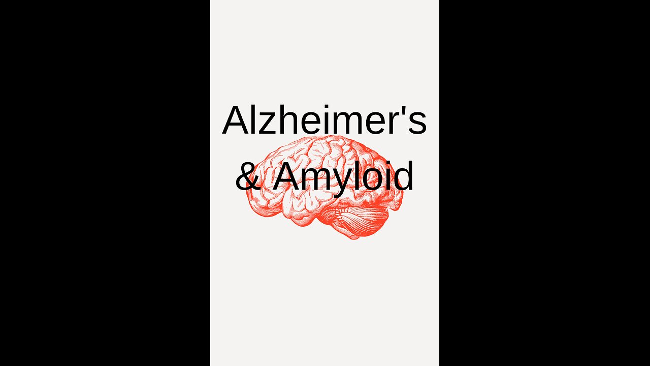 Drug that doesn't work on Alzheimer's