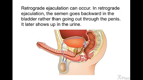 BEAR I MADE CALLED EJACULATION BUT INJACULATION