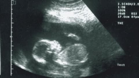50 Fetus- in da whomb