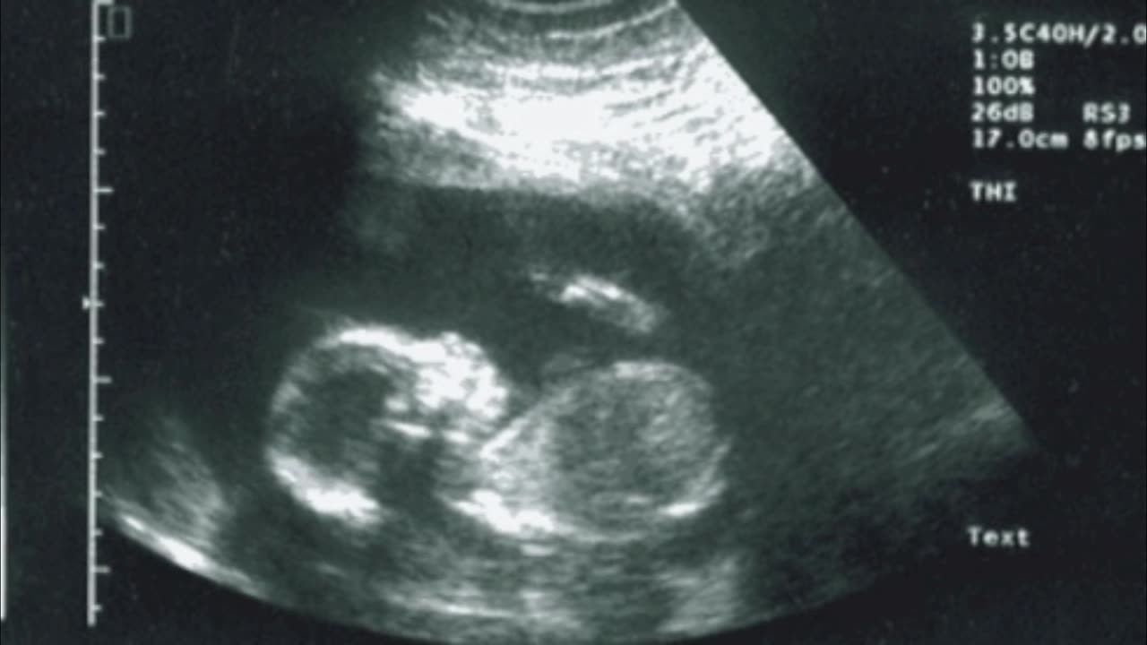 50 Fetus- in da whomb