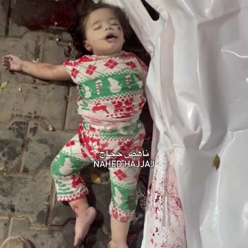 Two child martyrs and injured children arrived at Al-Shifa Hospital