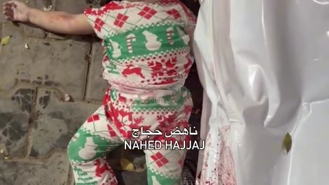 Two child martyrs and injured children arrived at Al-Shifa Hospital