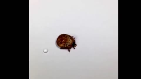 This woman asked me to take a look at this growth on her side For medical education NSFE