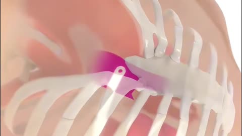 How Doctors Fix a Sunken Chest?