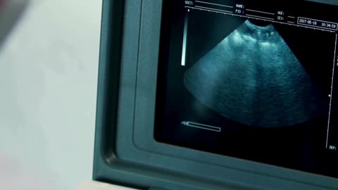 Empowering Parenthood with Personalized IUI Treatments at Sumathi Hospital