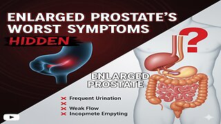 Enlarged Prostate’s Worst Symptoms (Hidden)
