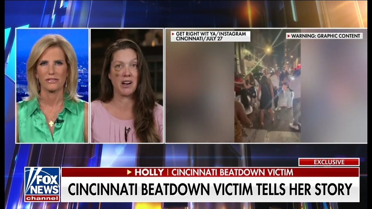 Cincinnati Attack Victim Slams Insulting Police Chief For Calling The Beatdown An Incident