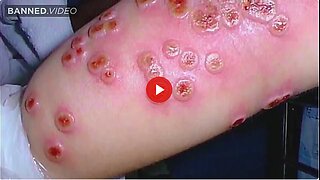 Did The CDC Start A New Pandemic In Pennsylvania?