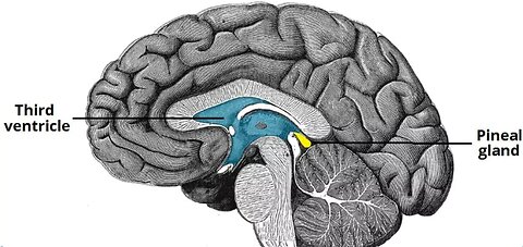 Molecular Changes Underlying Reduced Pineal Melatonin Levels in Alzheimer Disease