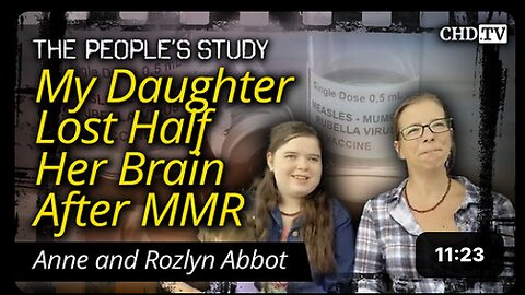 "MMR Vaccine Results in Loss of Half Brain Function in Ohio Girl"
