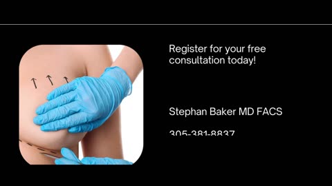 Stephan Baker MD FACS
