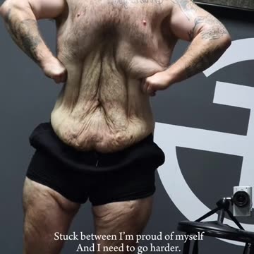 An amazing weight loss