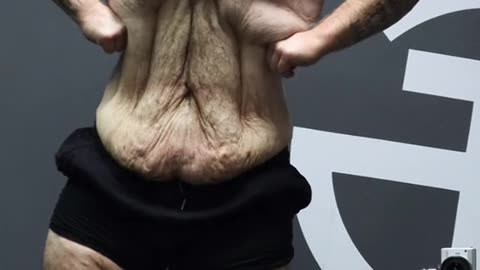 An amazing weight loss