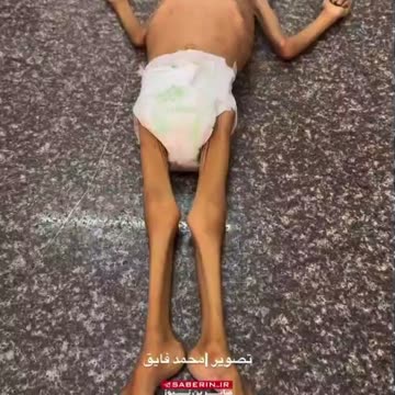 Jews are starving the Palestinians like they did the White Christian Nations