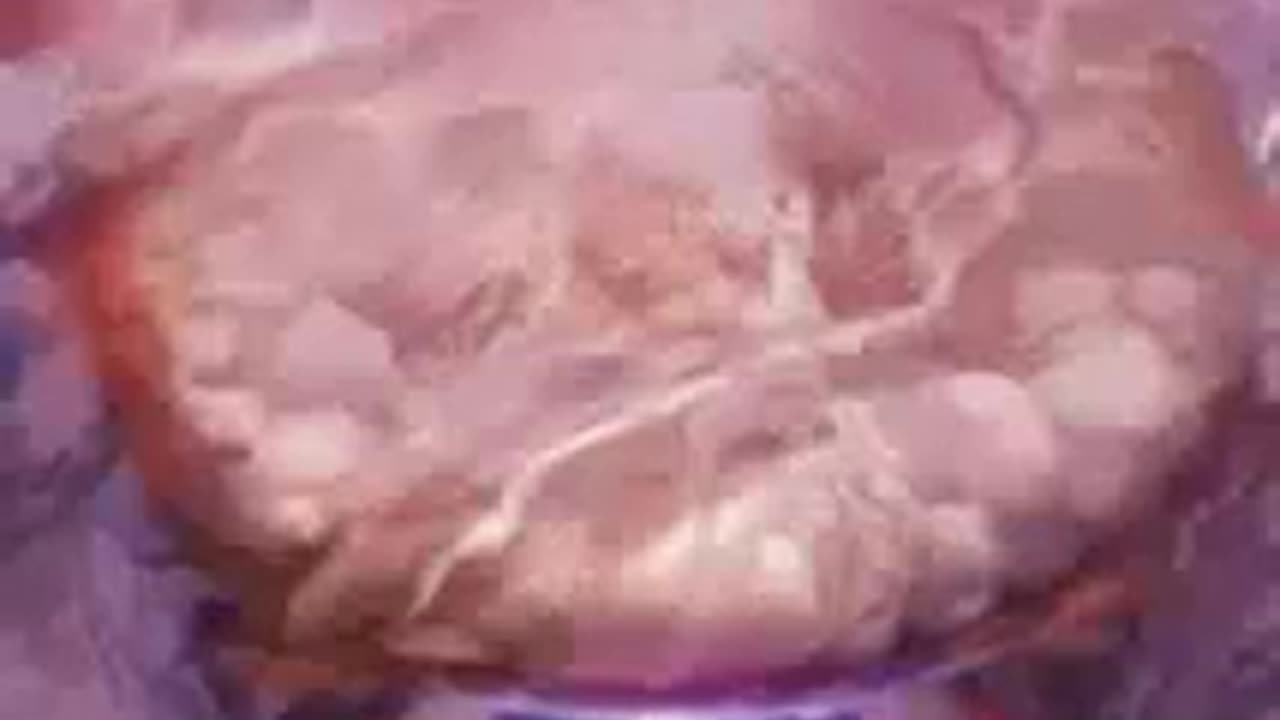Cómo Ainz Ooal Gown usó Beholders para capturar a los atacantes de Shalltear Highlord