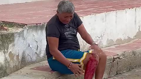 DOG BITE PRANK!!!