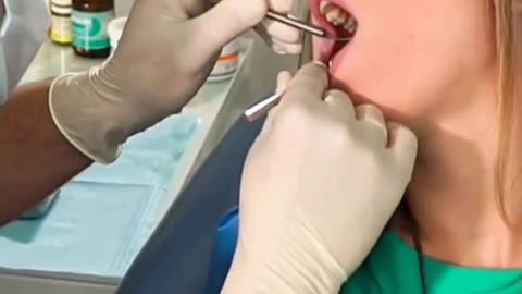 Tooth Pain That Won’t Stop Here’s How Dental Surgery Brings Instant Relief!