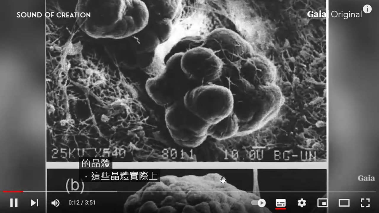 crystals found in the pineal gland