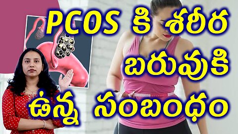 PCOS కి శరీర బరువుకి ఉన్న సంబంధం Connection Between PCOS and Obesity? Best Homeopathy Treatment Cure