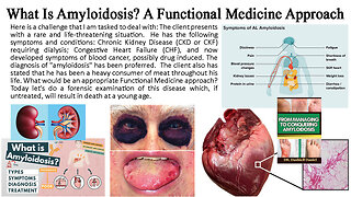 What Is Amyloidosis? A Functional Medicine Approach