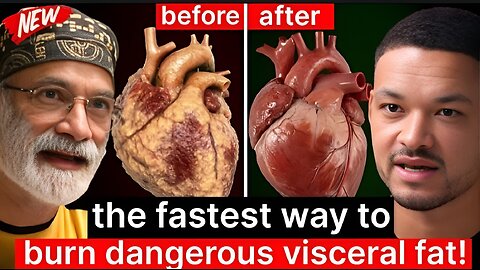 Insulin & Heart Doctor: The Fastest Way to Burn Visceral Fat ! This Is Clotting Your Blood