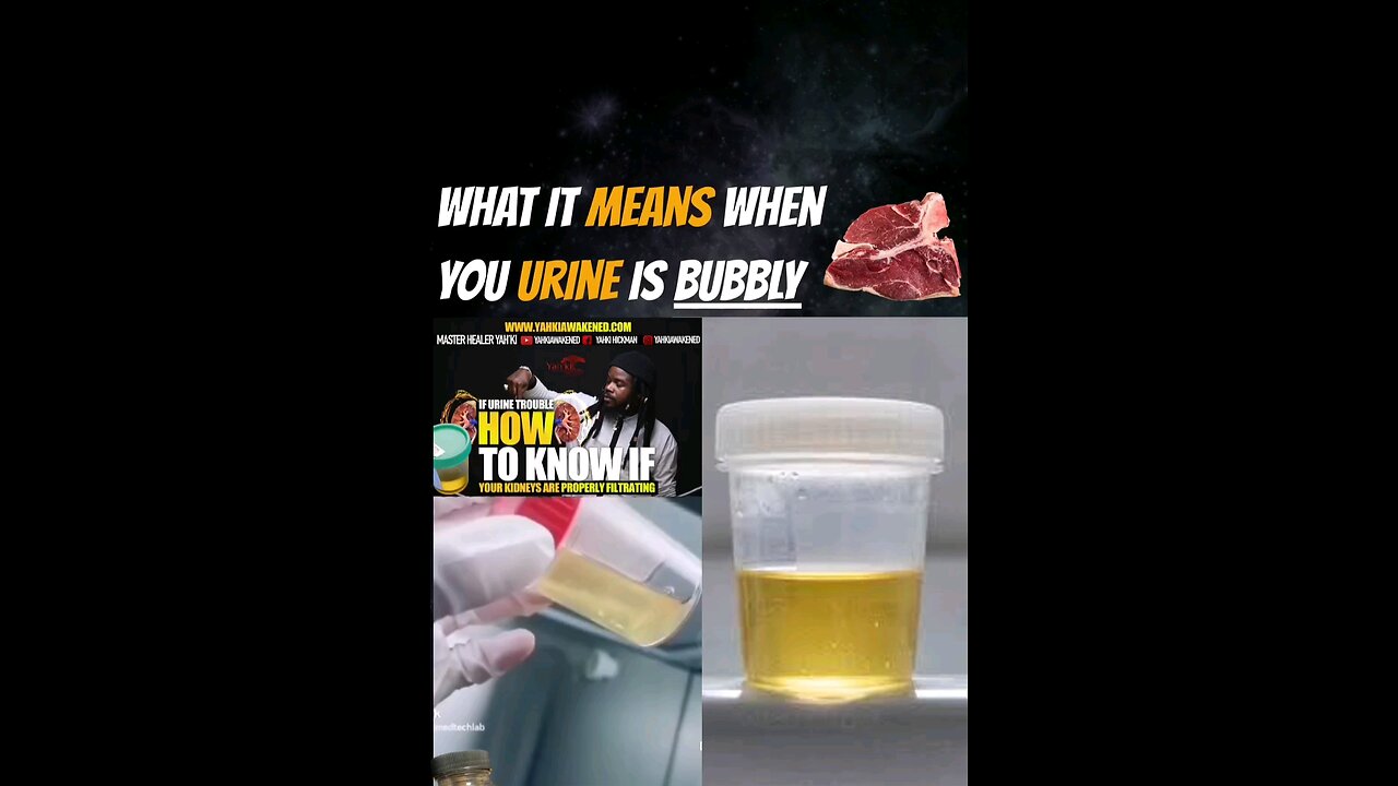 WHAT IS MEANS WHEN YOUR URINE IS BUBBLY