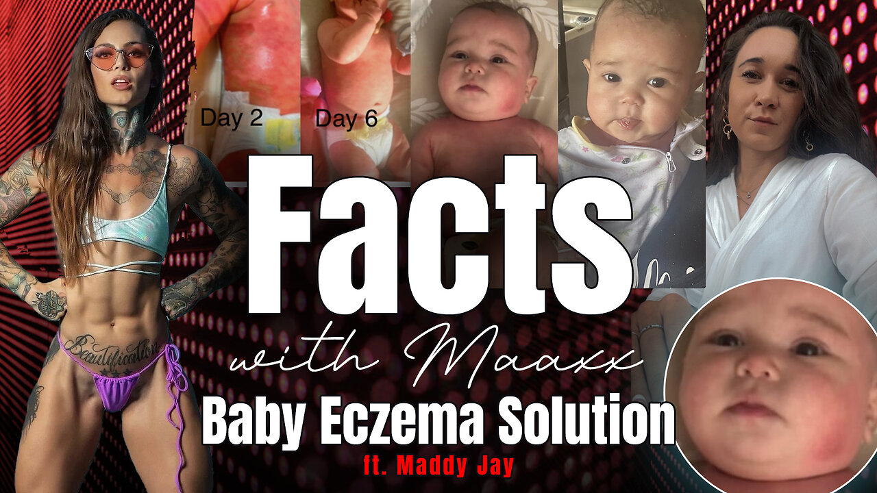 Facts with Maaxx - Ep 30 - Baby Eczema Solution