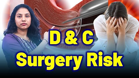 Risks of Dilation and Curettage Surgery | Treatment & Cure | Homeopathy, Medicine