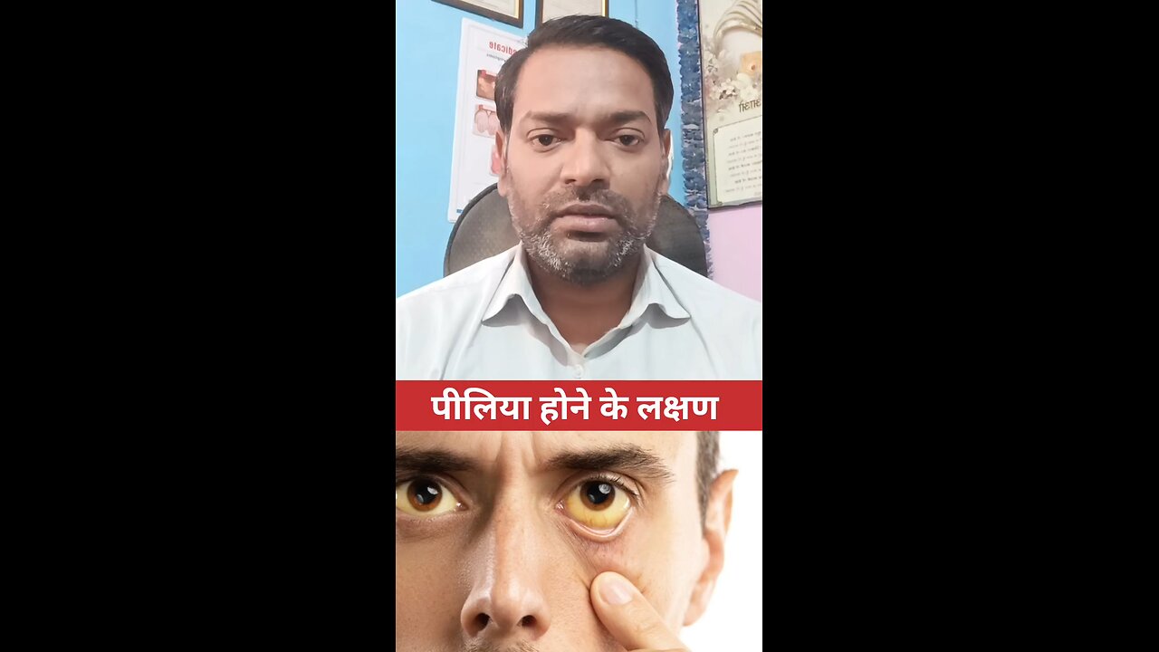 पीलिया होने के लक्षण ।